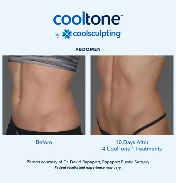 CoolTone by CoolSculpting in Redmond, Oregon